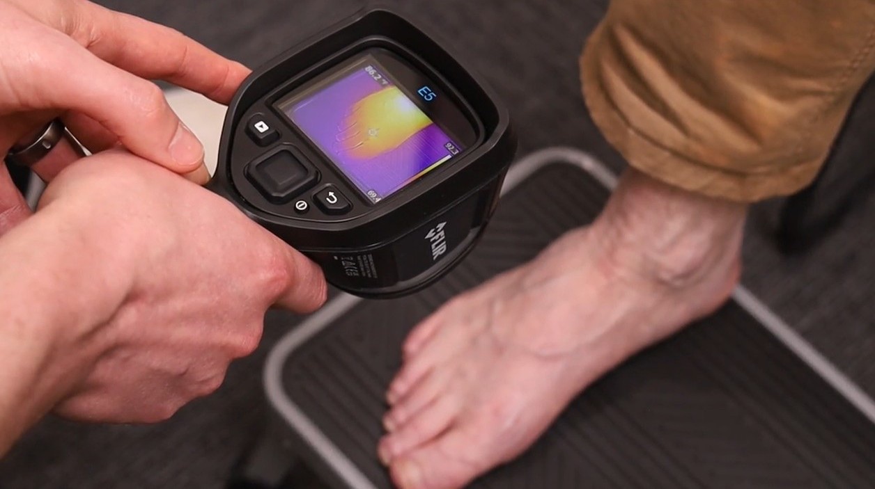 Dr. Emmerich holding a thermal camera over a patient's foot during a neuropathy exam