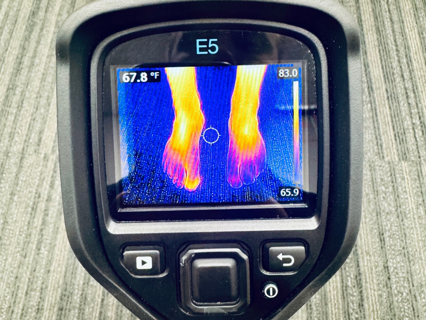 A thermal camera showing the temperature pattern in a patient's feet
